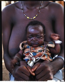 Burkina Faso, Poni province, Lobi land, Loropéni, lobi woman holding her sick child