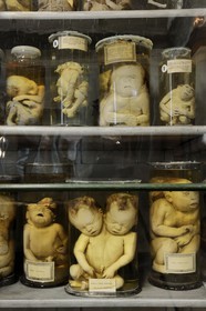 France, Hérault (34), Montpellier, centre historique, faculté de médecine, le musée d'anatomie, foetus de la collection de tératologie qui est l'étude scientifique des malformations congénitales